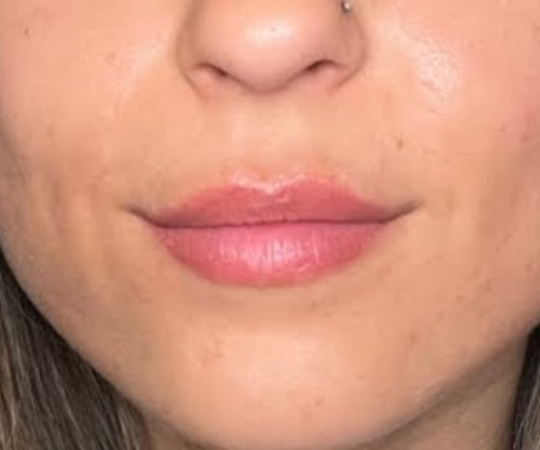 Lip Blush After Picture