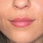 Lip Blush After Picture