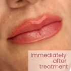 Photo Gallery Lip Blush