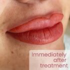 Permanent Makeup Lip Blush Photo gallery - Immediately after Treatment