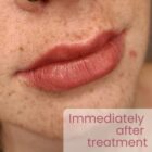 Permanent Makeup Lip Blush Photo gallery - Immediately after Treatment