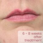 Permanent Makeup Lip Blush Photo gallery - 6-8 weeks after Treatment