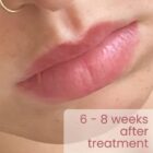 Permanent Makeup Lip Blush Photo gallery - 6-8 weeks after Treatment