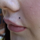 Permanent Make-up - Beauty Spot Tattoo