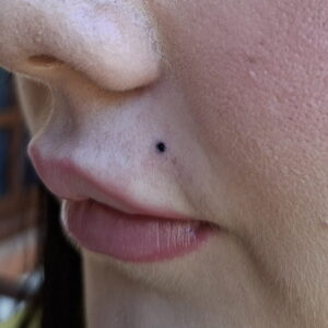 Permanent Make-up - Beauty Spot Tattoo